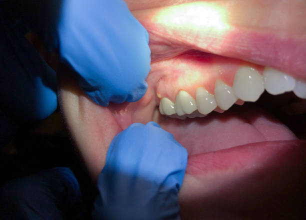Best Mobile Emergency Dentist in Buckner, MO