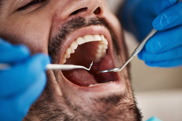 Best Emergency Dental Services for Seniors in Buckner, MO