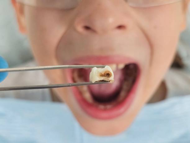 Best Orthodontic Emergency Dentist in Buckner, MO